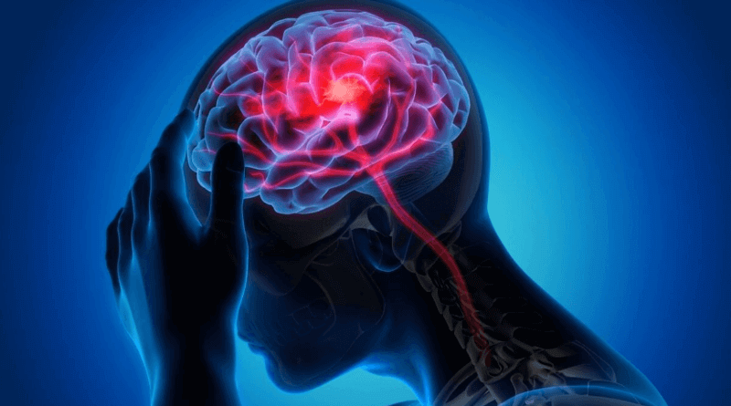 Sreesai Ayurvedics - Service - Neurological Problems